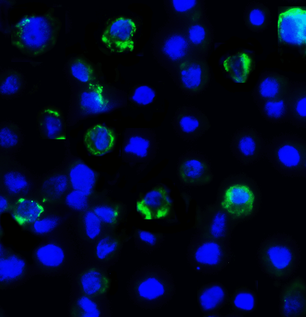 Monoclonal Mouse anti-Human LAG3 Antibody (clone 6B12, IHC, IF)