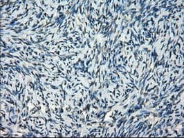 Monoclonal Mouse anti-Human FRK Antibody (clone OTI6D2, IHC, IF, WB)