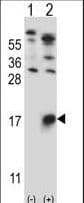 GYPB / CD235b / Glycophorin B Antibody (aa22-51)