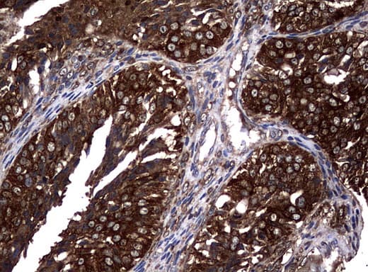 NME1 / NM23 Antibody (clone UMAB94)