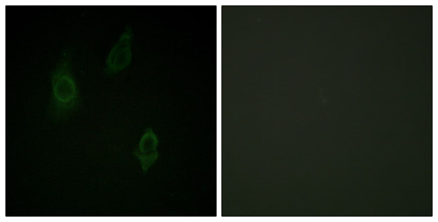 PKC / Protein Kinase C Antibody (phospho-Thr497)