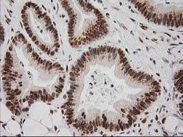 LOX / Lysyl Oxidase Antibody (clone OTI9G2)