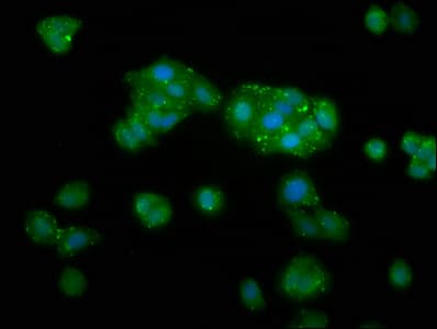 TKFC / DAK Antibody