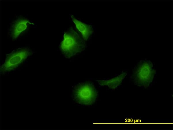 IHC-plus™ CCT5 / TCP1 Epsilon Antibody (clone 4E5-4B1)