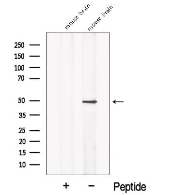 NPTX2 Antibody