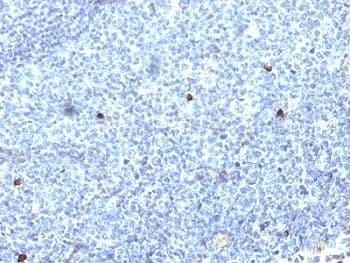 HLA-A25 + HLA-Aw32 Antibody (clone SPM418)