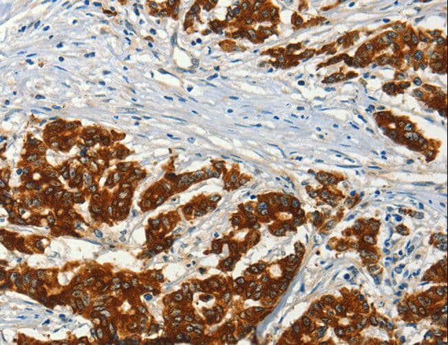 ADCY3 / Adenylate Cyclase 3 Antibody (aa855-1144)