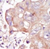 MAP4K3 / GLK Antibody (aa423-453)