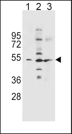 IHC-plus™ SLC36A1 Antibody (aa1-30)