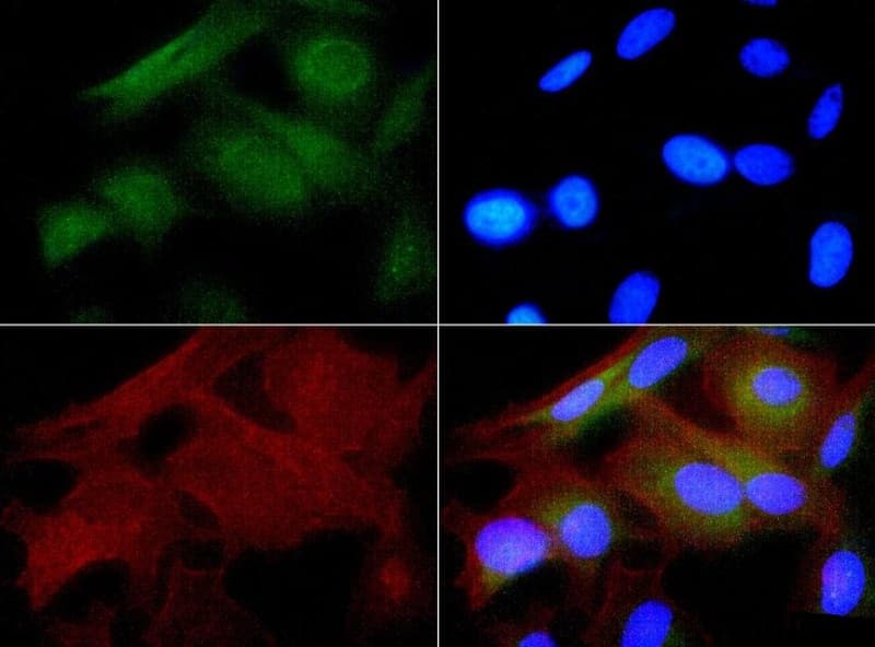 HSPB1 / HSP27 Antibody