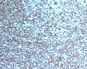 Nucleolar Antigen Antibody (clone NCM102-1)