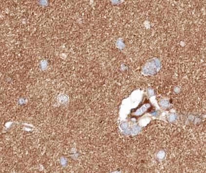 GABBR1 / GABA B Receptor 1 Antibody