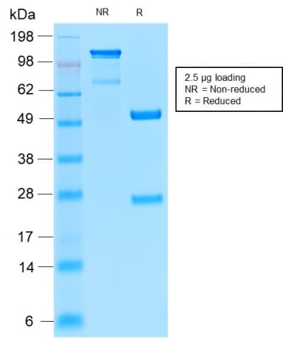Recombinant Monoclonal Rabbit anti-Human CD52 Antibody (clone CD52/2276R, Azide-free,Carrier-free, IHC)