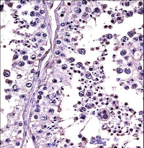 RLN1 + RLN2 / Relaxin 1+2 Antibody (aa136-165)