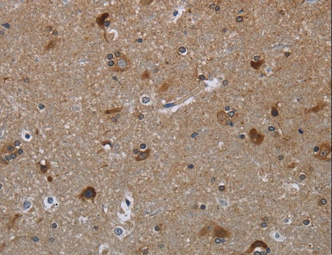 GYS2 Antibody