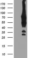 BIRC3 / cIAP2 Antibody (aa255-529, clone OTI1A9)