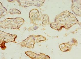 MAGE10 / MAGEA10 Antibody (aa2-225)