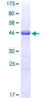Human HLA-DQB2 Protein (Recombinant GST)