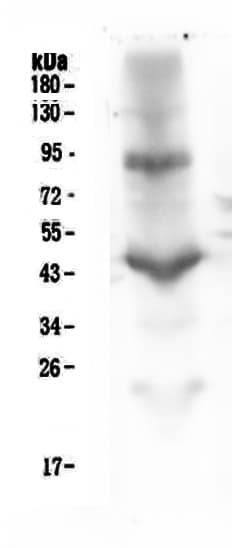 Monoclonal Mouse anti-Human ITGB2 / CD18 Antibody (IHC, WB)