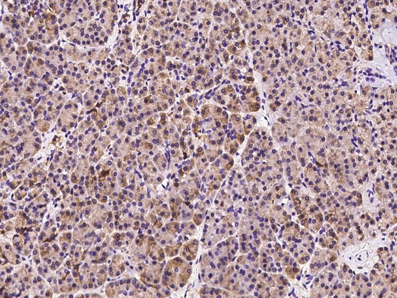 Polyclonal Rabbit anti-Human AHCYL1 / DCAL Antibody (IHC, IF, WB)