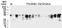 BAR / BFAR Antibody (aa3-21)