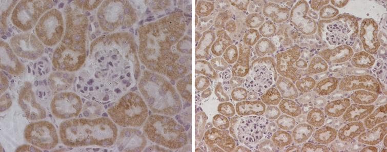 Polyclonal Rabbit anti-Mouse HTR2C / 5-HT2C Receptor Antibody (IHC)