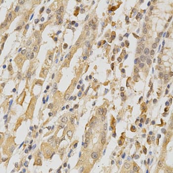 COL5A1 / Collagen V Alpha 1 Antibody