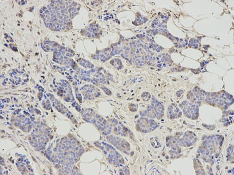 Polyclonal Rabbit anti-Human RRM2 Antibody (IHC, IF, WB)