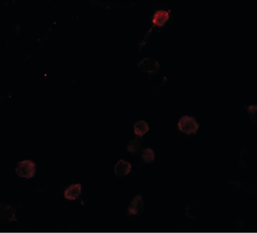 IHC-plus™ Polyclonal Rabbit anti-Human SEPT1 / Septin 1 Antibody (IHC, IF, WB)