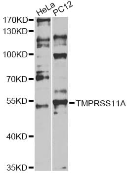 TMPRSS11A Antibody