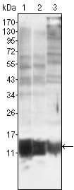 IHC-plus™ S100A10 Antibody (clone 4E7E10)
