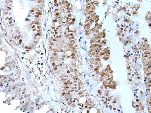 ZNHIT3 Antibody