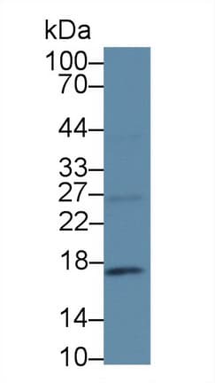 p16INK4a / CDKN2A Antibody (aa8-156)