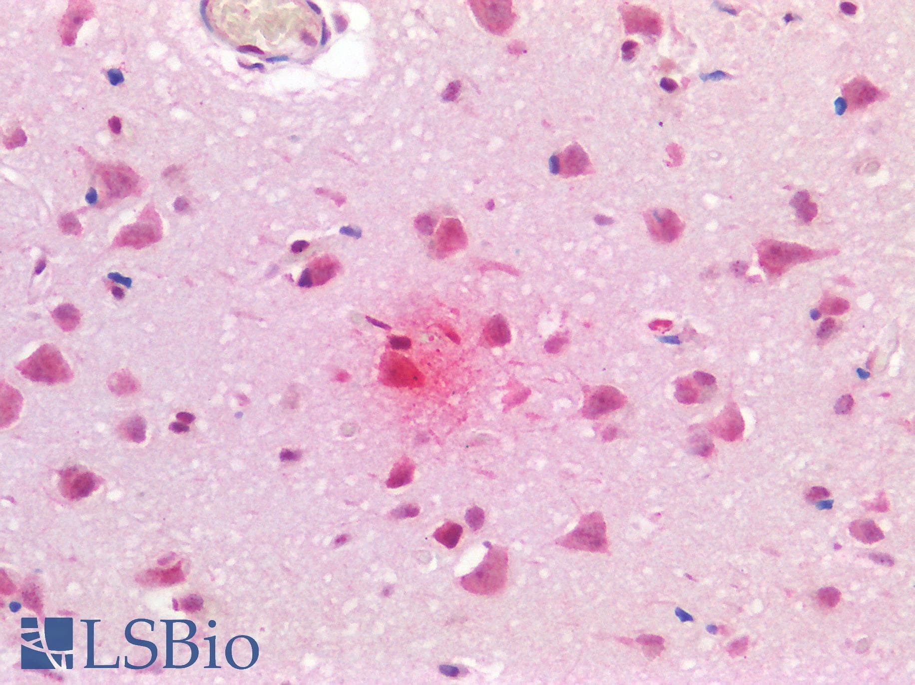 IHC-plus™ Polyclonal Rabbit anti-Human MAPT / Tau Antibody (IHC, WB)