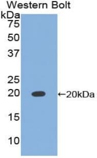 TIMP1 Antibody (aa32-207)