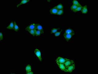 PathPlus™ Polyclonal Rabbit anti-Human APOE / Apolipoprotein E Antibody (IHC, IF)