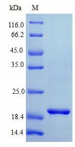 Human IFNL1 / IL29 Protein (Recombinant)