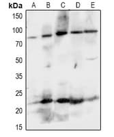 EPHA8 / EPH Receptor A8 Antibody