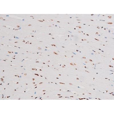 Polyclonal Rabbit anti-Human RELA / NFKB p65 Antibody (phospho-Thr435, IHC, IF, WB)