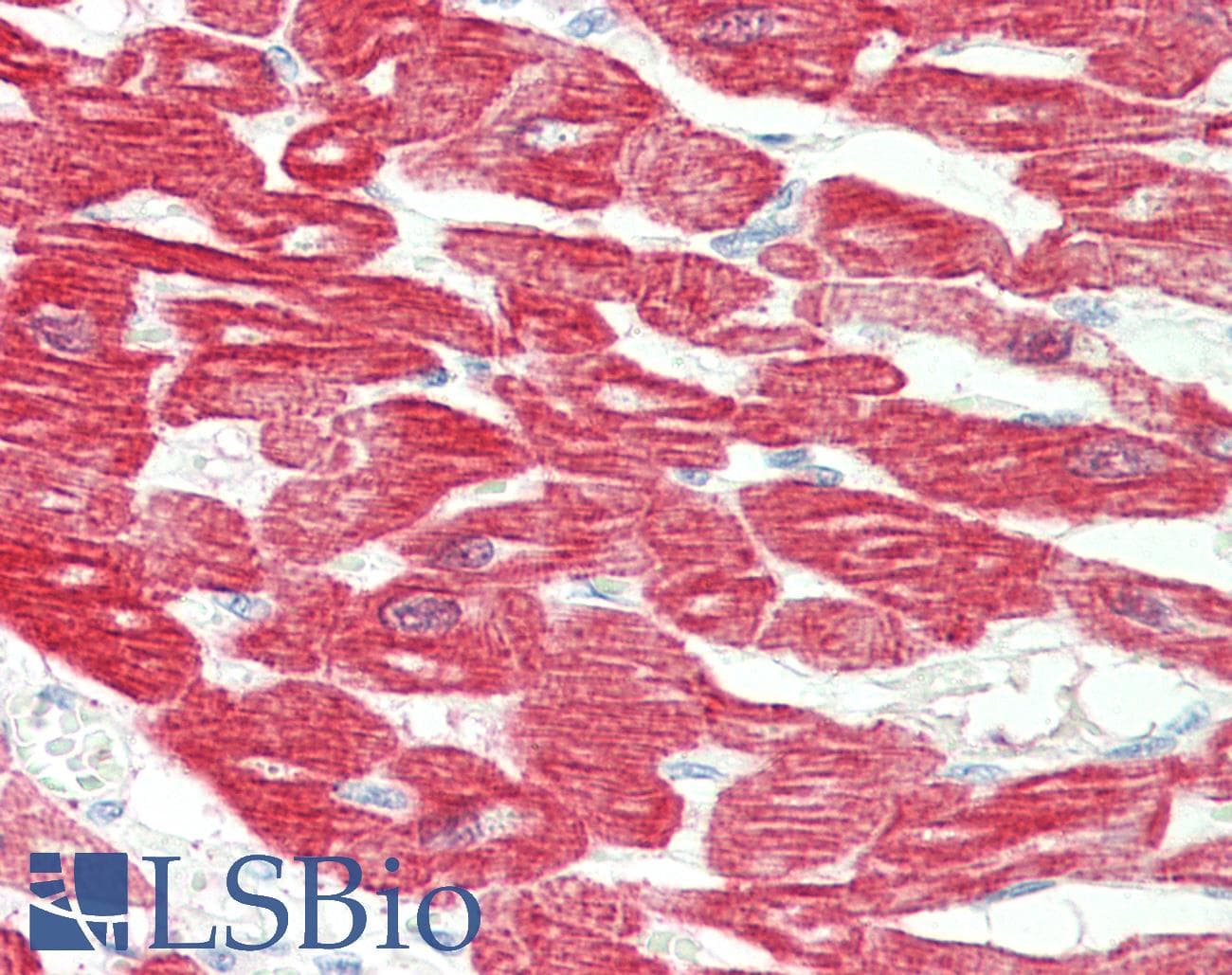IHC-plus™ Monoclonal Mouse anti-Human TNNI2 Antibody (clone 2F12G2, IHC, IF, WB)