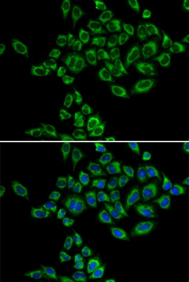 SRPK1 Antibody
