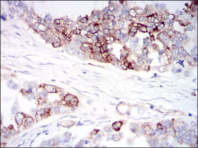 IGFBP7 / TAF Antibody (aa52-156, clone 1D9E7)