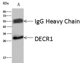 DECR1 Antibody (Preservative Free)