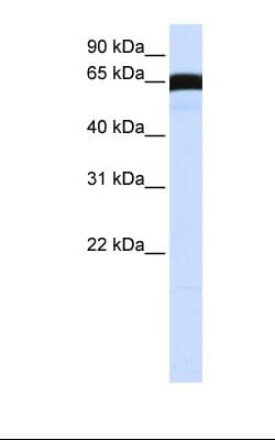 PLK1 / PLK-1 Antibody (C-Terminus)