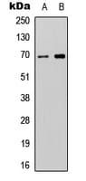 Polyclonal Rabbit anti-Human ATG16L2 Antibody (Internal, WB)