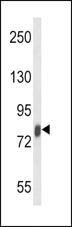 IHC-plus™ Polyclonal Rabbit anti-Human LF / LTF / Lactoferrin Antibody (IHC, WB)