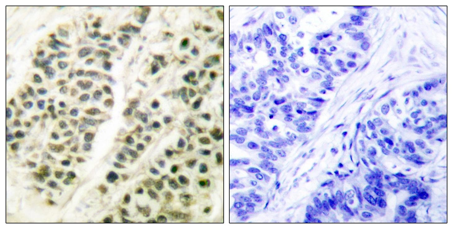 POLB / DNA Polymerase Beta Antibody