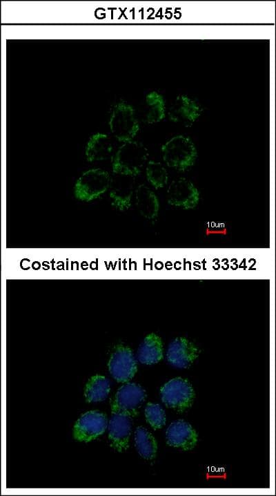 Polyclonal Rabbit anti-Human LETM1 Antibody (aa506-723, IHC, WB)