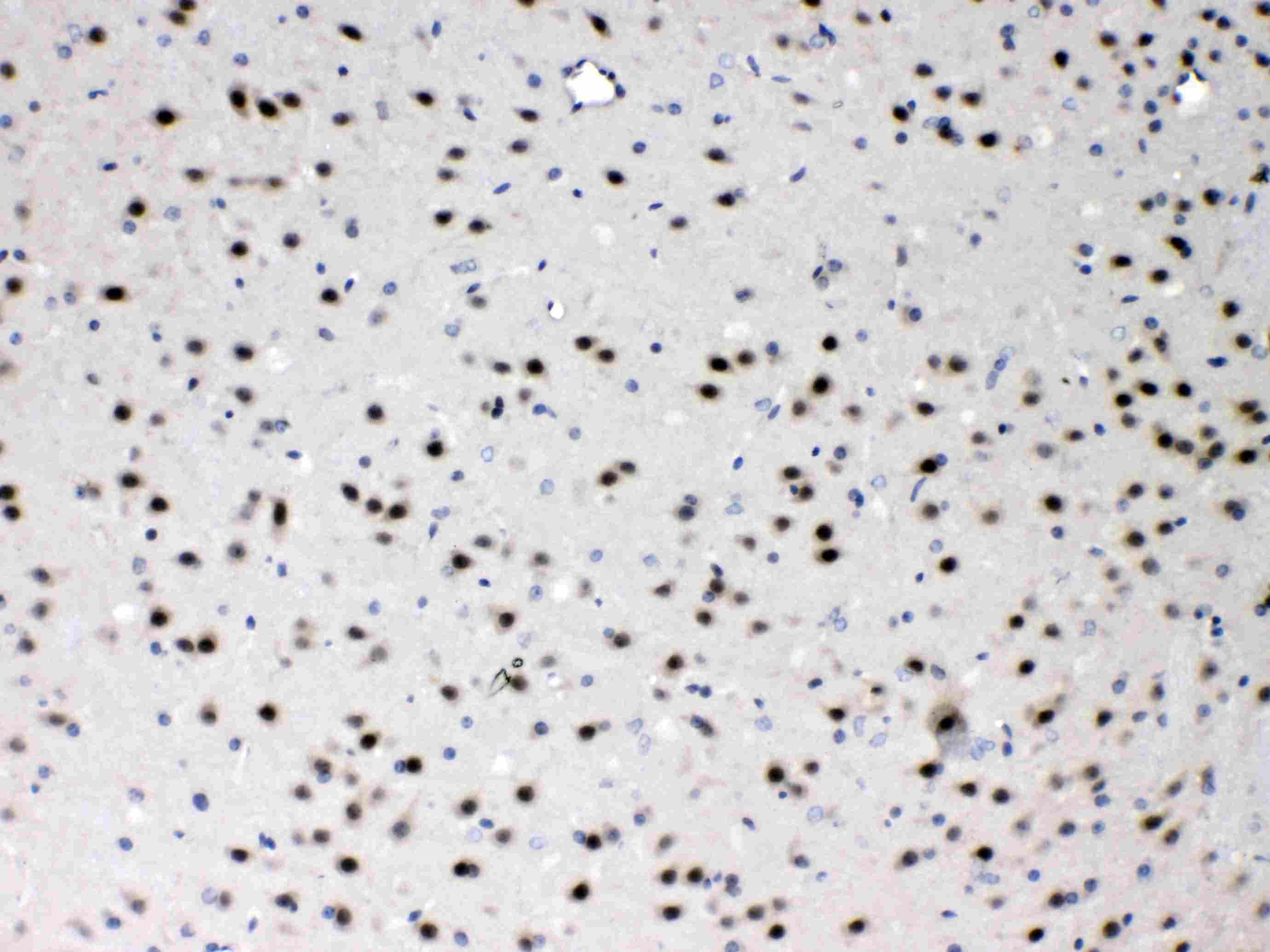 PSMA3 Antibody