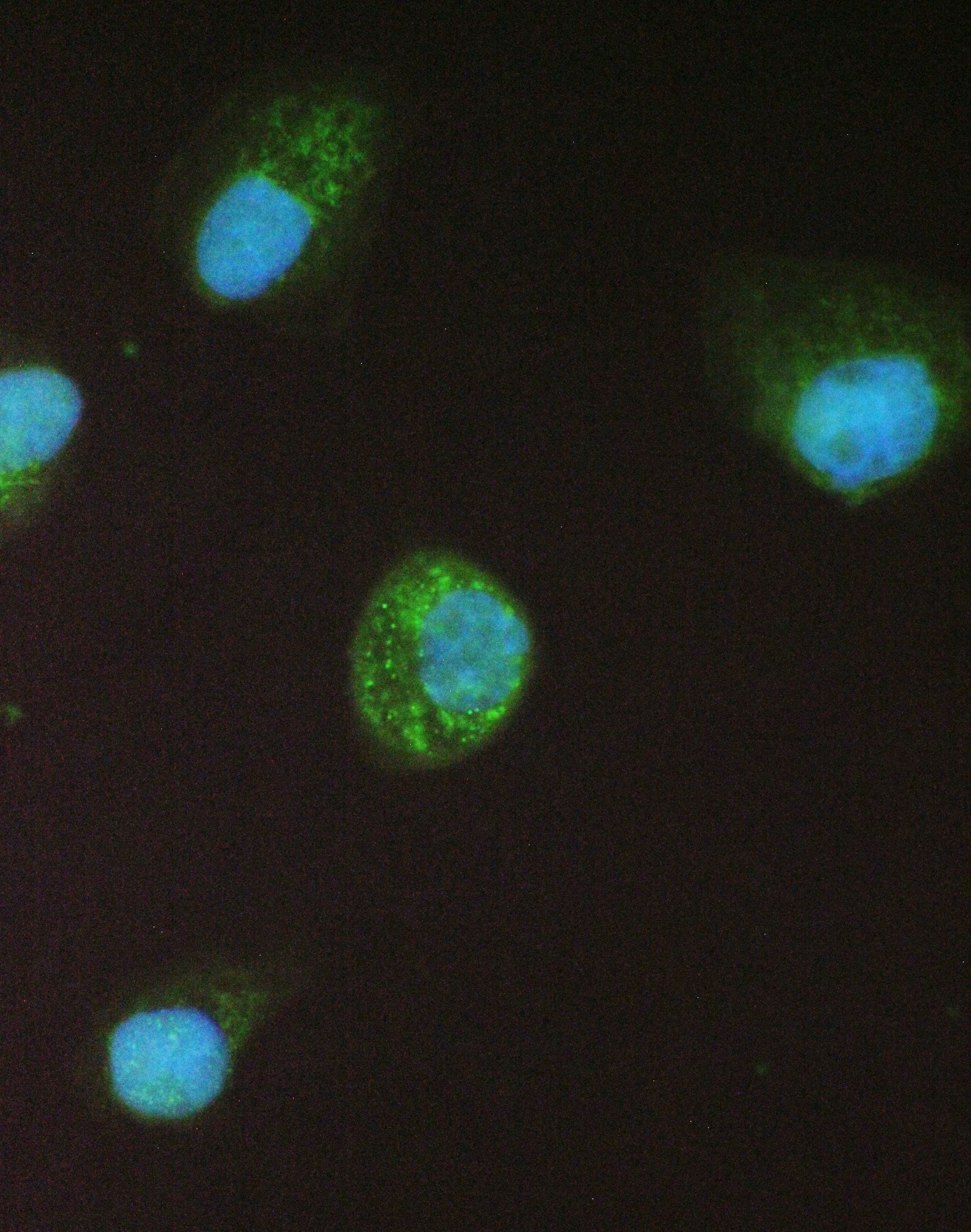 CLPP Antibody